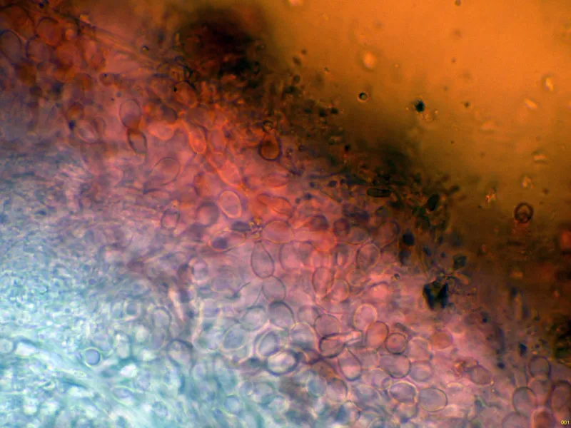 Ascocoryne albida 10 - Himenio-001